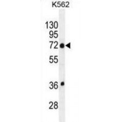 Transmembrane Protein 151B (TMEM151B) Antibody