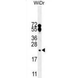 FA96A Antibody