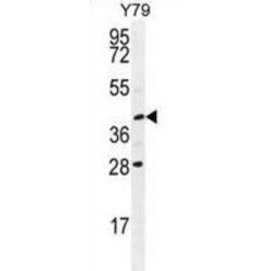 Inactive Ubiquitin Carboxyl-Terminal Hydrolase 50 (USP50) Antibody