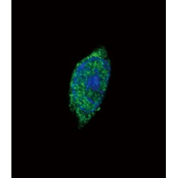 Tyrosine-Protein Kinase JAK2 (JAK2) Antibody