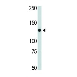 Tyrosine-Protein Kinase JAK2 (JAK2) Antibody