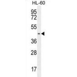 Probable G Protein Coupled Receptor 142 (GPR142) Antibody