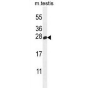 Inactive Phospholipase D6 (PLD6) Antibody