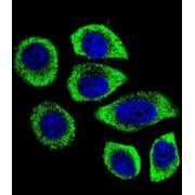 Phosphatidylinositol-4-Phosphate 5-Kinase Like 1 (PIP5KL1) Antibody