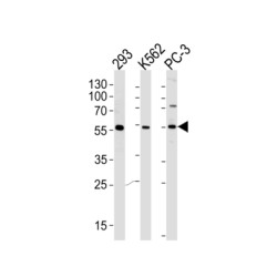Phosphatidylinositol-4-Phosphate 5-Kinase Like 1 (PIP5KL1) Antibody