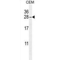ADP-Ribosylation Factor-Like Protein 8 (ARL5B) Antibody