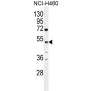 Carboxypeptidase A6 (CPA6) Antibody