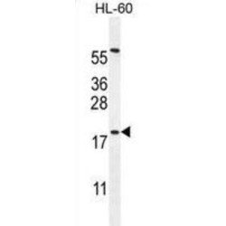 Developmental Pluripotency Associated 5 (DPPA5) Antibody