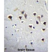 Glutamate Receptor Ionotropic, NMDA 2A (GRIN2A) Antibody