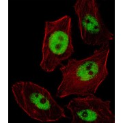 Paired Like Homeobox 2b (PHOX2B) Antibody