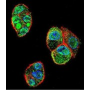 Zinc Finger Translocation-Associated Protein (ZFTA) Antibody