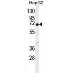 Uncharacterized Protein C11orf95 (C9JLR9) Antibody