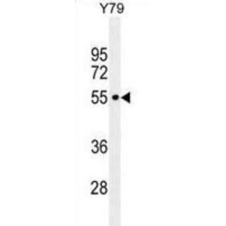 Coiled-Coil Domain-Containing Protein 97 (CCDC97) Antibody