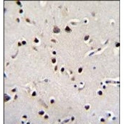 Leucine-Rich Repeat-Containing Protein 46 (LRRC46) Antibody