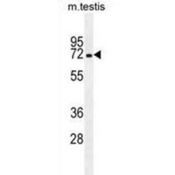 Mbt Domain Containing 1 (MBTD1) Antibody