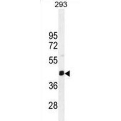 SERTA Domain-Containing Protein 4 (SERTAD4) Antibody