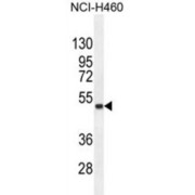 Fibronectin Type III Domain-Containing Protein 8 (FNDC8) Antibody