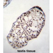 Testis-Specific Protein 10-Interacting Protein (TSGA10IP) Antibody