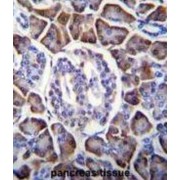 Lysophospholipase D GDPD1 (GDPD1) Antibody