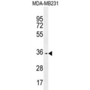 abx026254