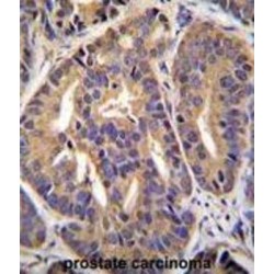 General Transcription Factor IIH, Polypeptide 2-Like Protein (GTF2H2C) Antibody