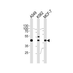 General Transcription Factor IIH, Polypeptide 2-Like Protein (GTF2H2C) Antibody