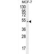 Western blot analysis of MCF-7 cell lysates (35 µg/lane) using Zinc Finger Protein 829 (ZNF829) Antibody.