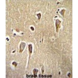 Corticotropin-Releasing Factor Receptor 2 (CRFR2) Antibody