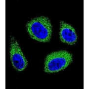 7-Dehydrocholesterol Reductase (DHCR7) Antibody