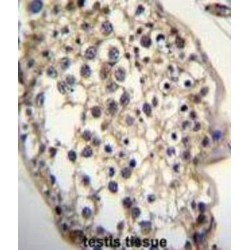 7-Dehydrocholesterol Reductase (DHCR7) Antibody