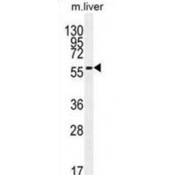 7-Dehydrocholesterol Reductase (DHCR7) Antibody