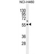 Coenzyme Q6, Monooxygenase (COQ6) Antibody
