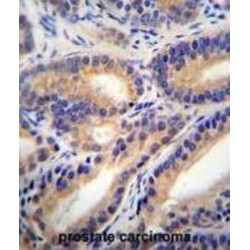 Hydroxysteroid 11-Beta-Dehydrogenase 1 Like Protein (HSD11B1L) Antibody