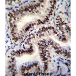 Heterogeneous Nuclear Ribonucleoprotein C-Like 1 (HNRNPCL1) Antibody