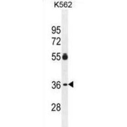 Epidermis-Specific Serine Protease-Like Protein (ESSPL) Antibody