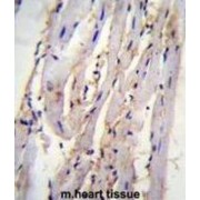 abx026289