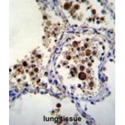 Sialic Acid Binding Ig Like Lectin 15 (SIGLEC15) Antibody