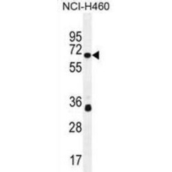 Zinc Finger Protein 433 (ZNF433) Antibody