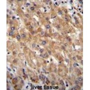abx026305