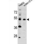 Potassium Channel Modulatory Factor 1 (KCMF1) Antibody