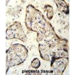 RSBN1 Antibody