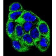 V-Type Proton ATPase Subunit B, Kidney Isoform (ATP6V1B1) Antibody