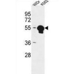 V-Type Proton ATPase Subunit B, Kidney Isoform (ATP6V1B1) Antibody