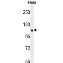 Serine/threonine-Protein Kinase QSK (KIAA0999) Antibody