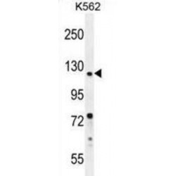 DEAD/H-Box Helicase 11 (DDX11) Antibody