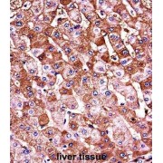 Hemoglobin Beta (HBB) Antibody