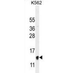 Hemoglobin Beta (HBB) Antibody