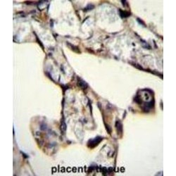 SAM And SH3 Domain-Containing Protein 1 (SASH1) Antibody