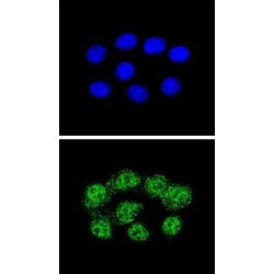 DNA Mismatch Repair Protein Msh2 (MSH2) Antibody