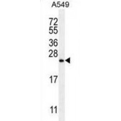 Sorting Nexin-24 (SNX24) Antibody